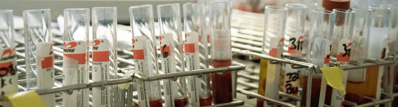 Prophylaxie animale : les cheptels au microscope