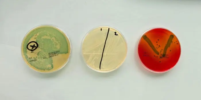 Listeria monocytogenes : un risque discret à surveiller particulièrement en été